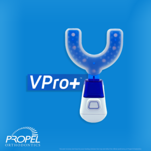 Propel P1C_VPro+ speeds up the Invisalign Treatment process