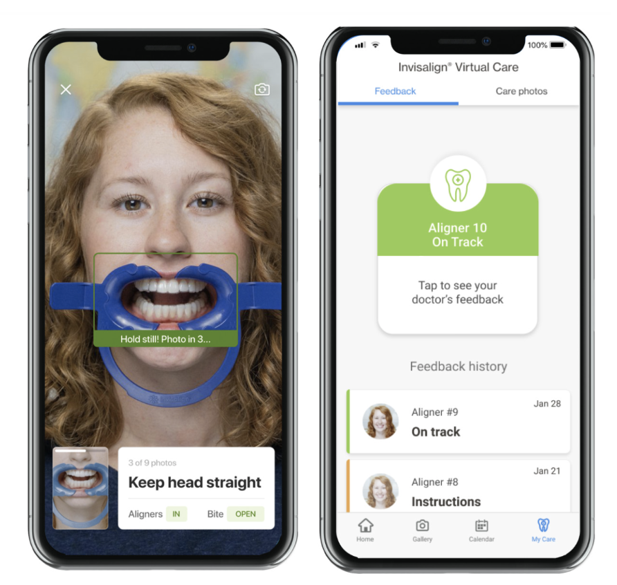 Invisalign Virtual Care